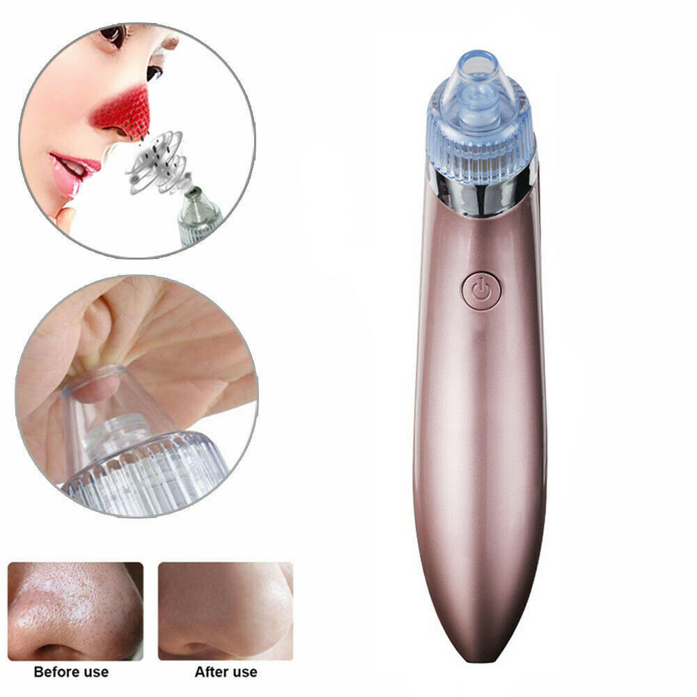 LINTROVA™ Electric Blackhead Remover & Pore Vacuum Cleaner