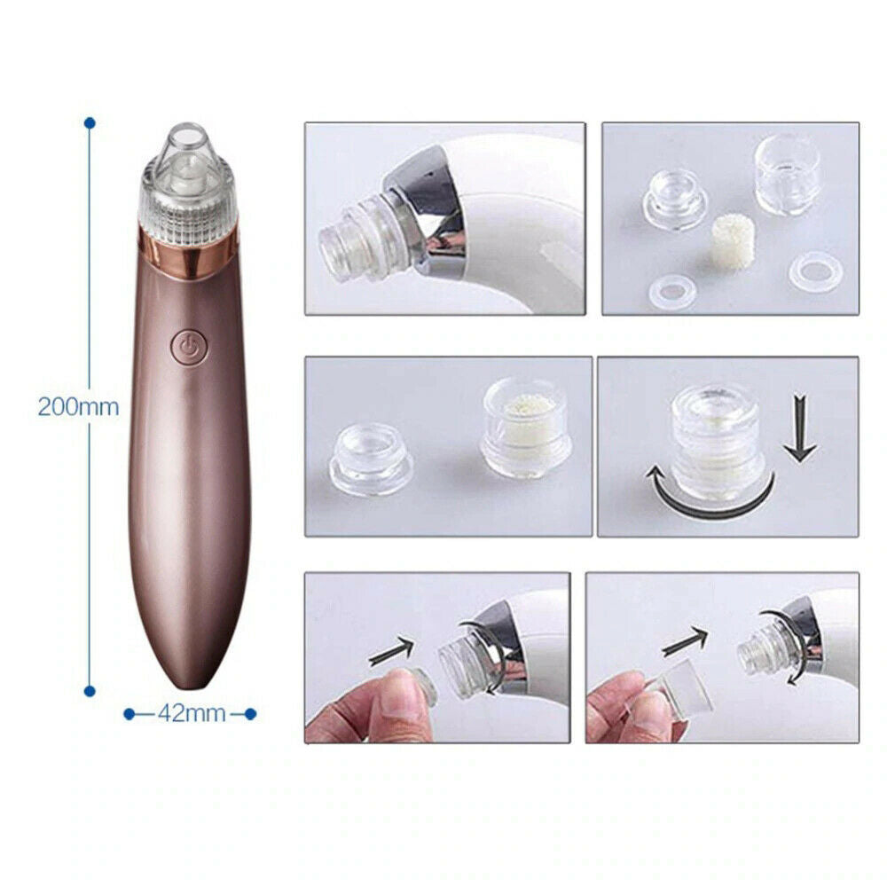 LINTROVA™ Electric Blackhead Remover & Pore Vacuum Cleaner