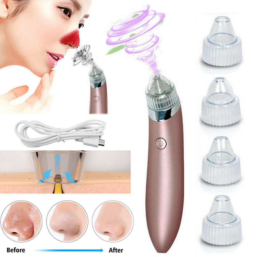 LINTROVA™ Electric Blackhead Remover & Pore Vacuum Cleaner
