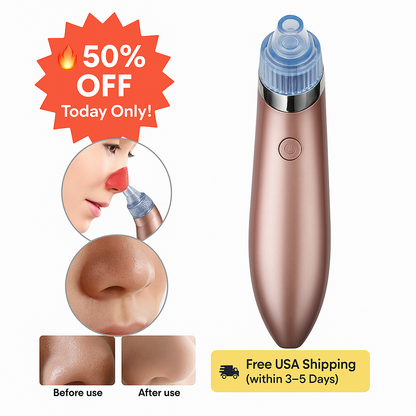LINTROVA™ Electric Blackhead Remover & Pore Vacuum Cleaner